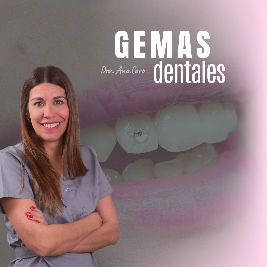 28/09/26 - Gemas Dentales